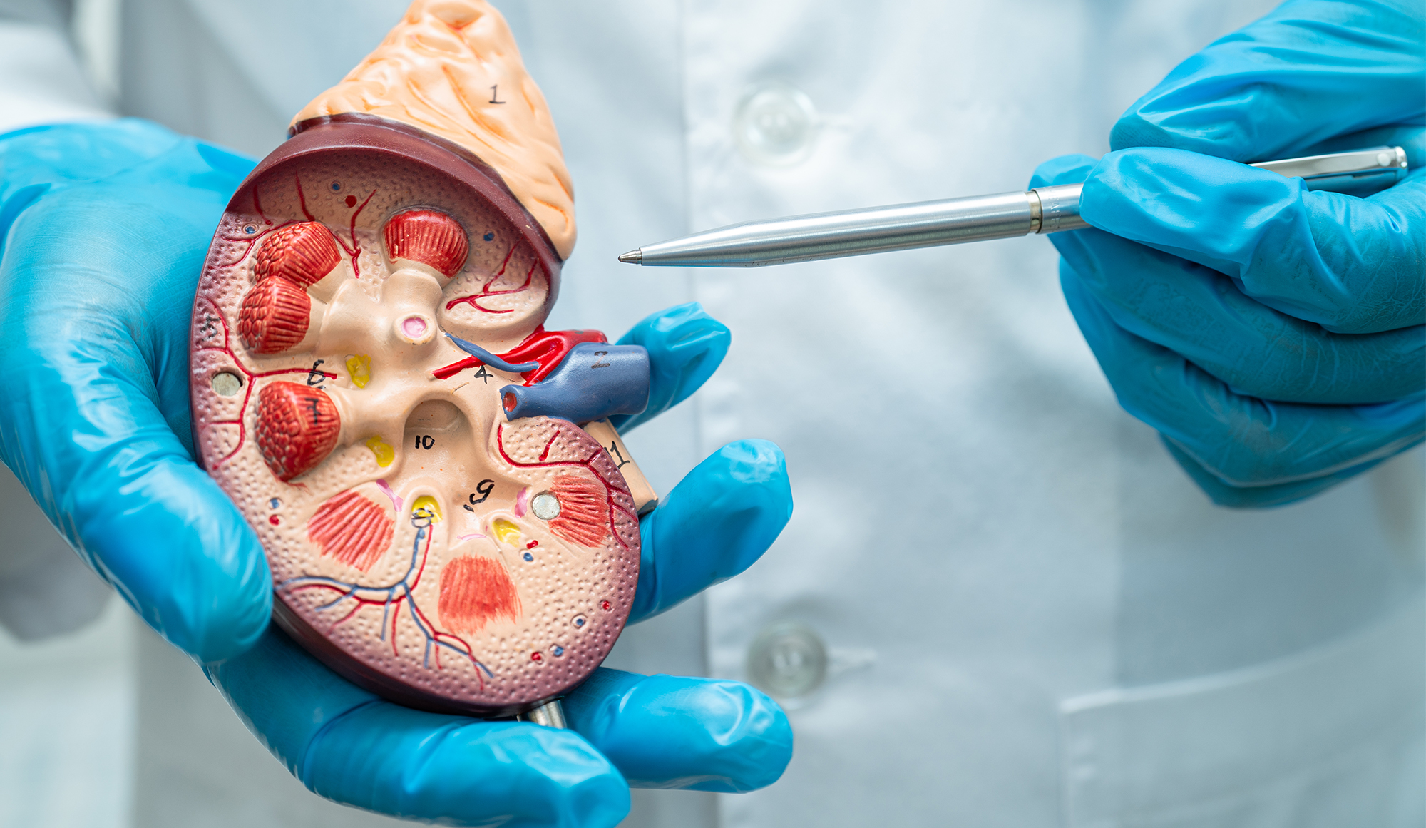 Partial Nephrectomy: A Urologist’s Guide